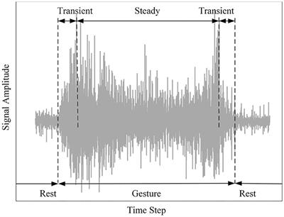 Gesture Recognition Using Surface Electromyography and Deep Learning for Prostheses Hand: State-of-the-Art, Challenges, and Future